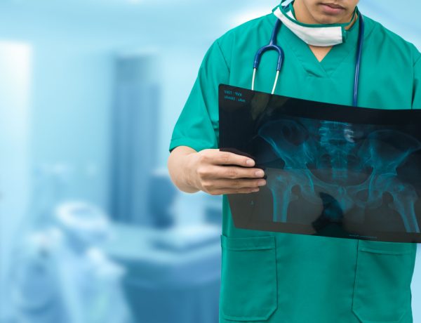 Surgical doctor examining xray film, diagnose patient 's waist bone. Surgery operation concept.